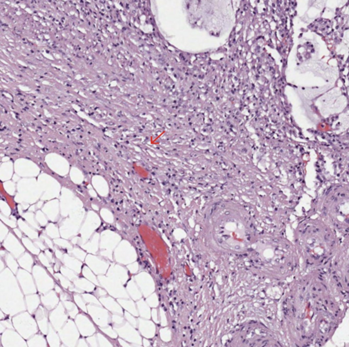 <p>Colon</p>