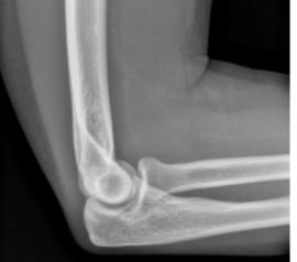 <p>What is this </p>