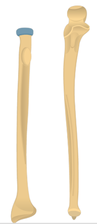 <p>Articulates with capitulum of humerus and radial notch of ulna</p>