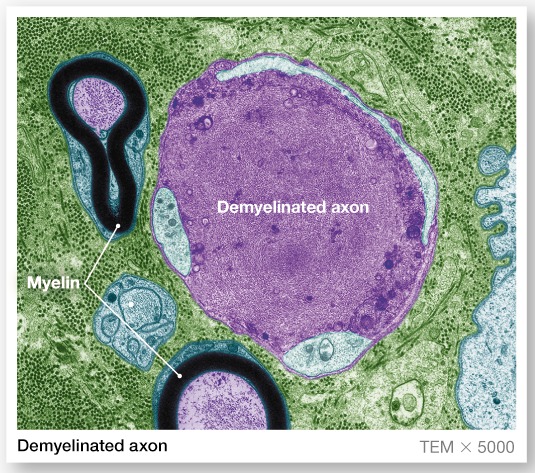 <p>A Schwann cell surrounds nerve fibers, but coiling does not take place Schwann cells partially enclose 15 or more axons</p>