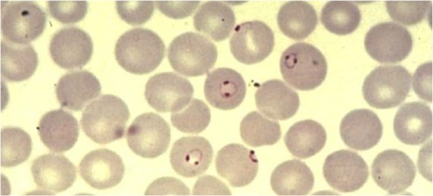 <p>multiple rings?, won't see mature trophozoites or schizonts bc sequestered in circulatory system!</p>