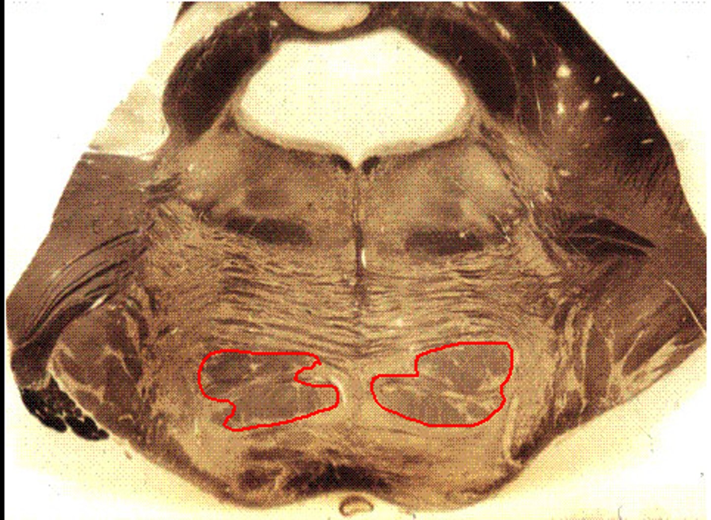 <p>Corticobulbar and Corticopontine fibers are also in this area</p>