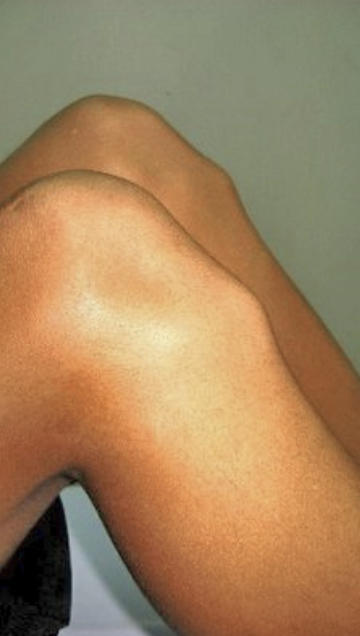 what injury is this?