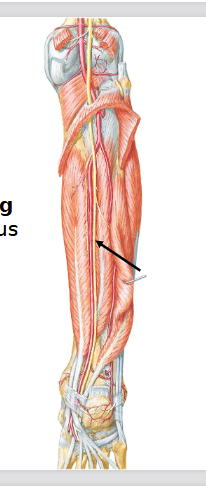 <p>Tibial Nerve</p>