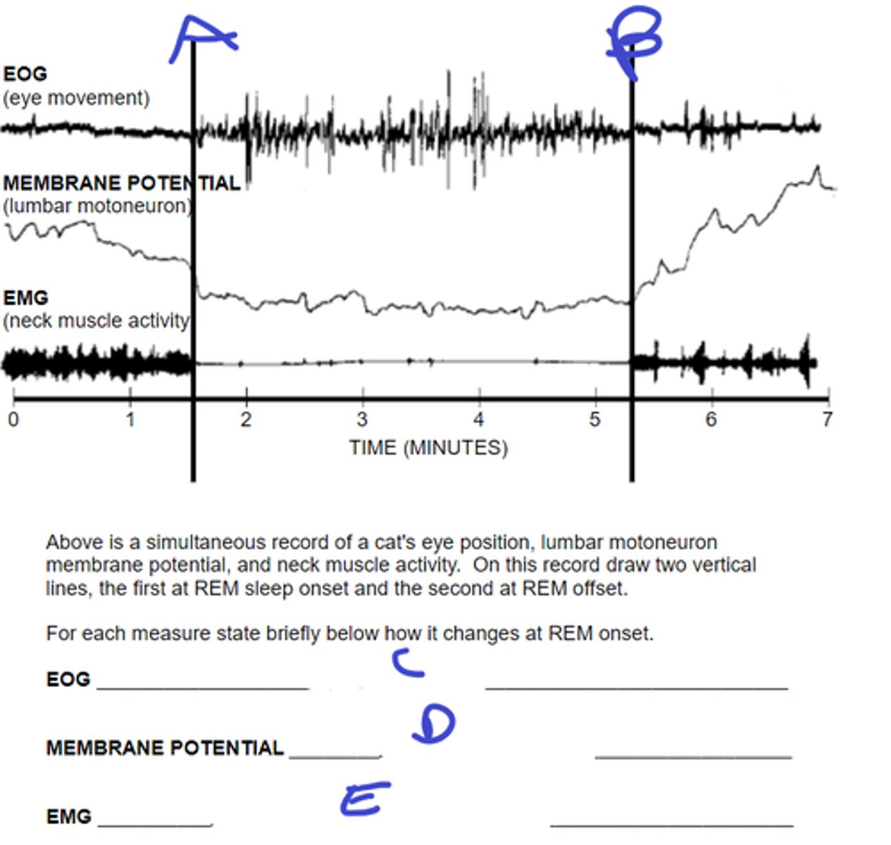<p>C: describe movement during REM onset</p>