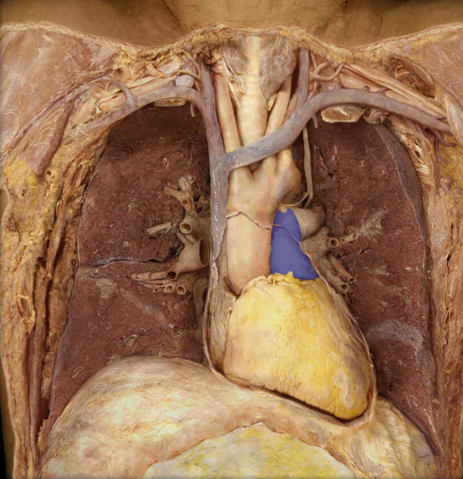 <p>Identify the structure</p>