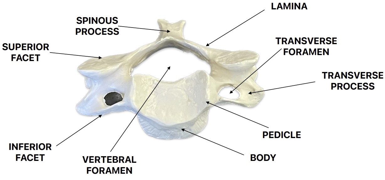 <p>What are these landmarks of:</p><ul><li><p>Transverse foramen - hole of wing tip</p></li><li><p>Transverse process - wing tip</p></li><li><p>Vertebral body - main body</p></li><li><p>Spinous process - long tip, points downward</p></li><li><p>Lamina - connect SP to wings (lay on back)</p></li><li><p>Pedicle - connect body to wings (p in front)</p></li><li><p>Vertebral foramen - big hole</p></li><li><p>Superior &amp; Inferior facets - circular concave surface on top and bottom</p></li></ul><p></p>