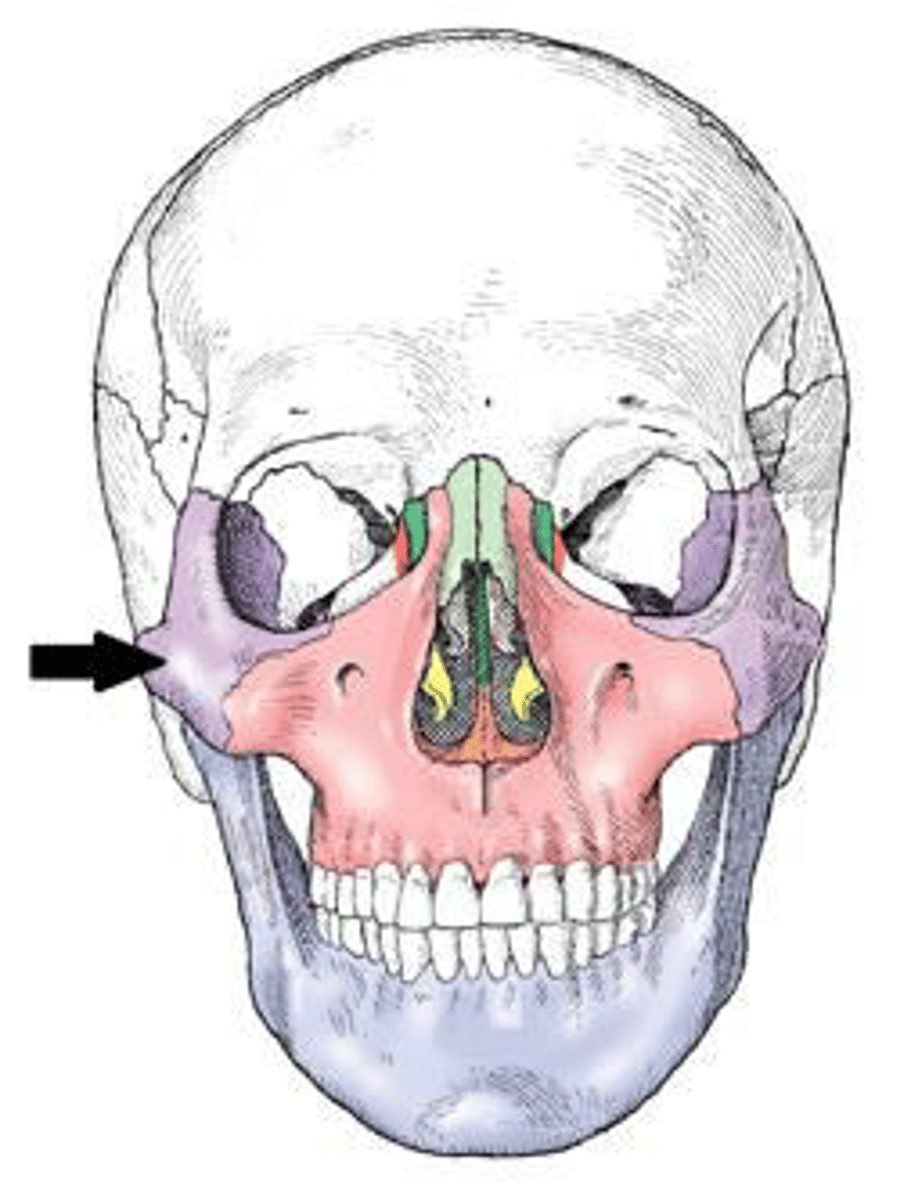 <p>d. zygoma</p><p>3 multiple choice options</p>