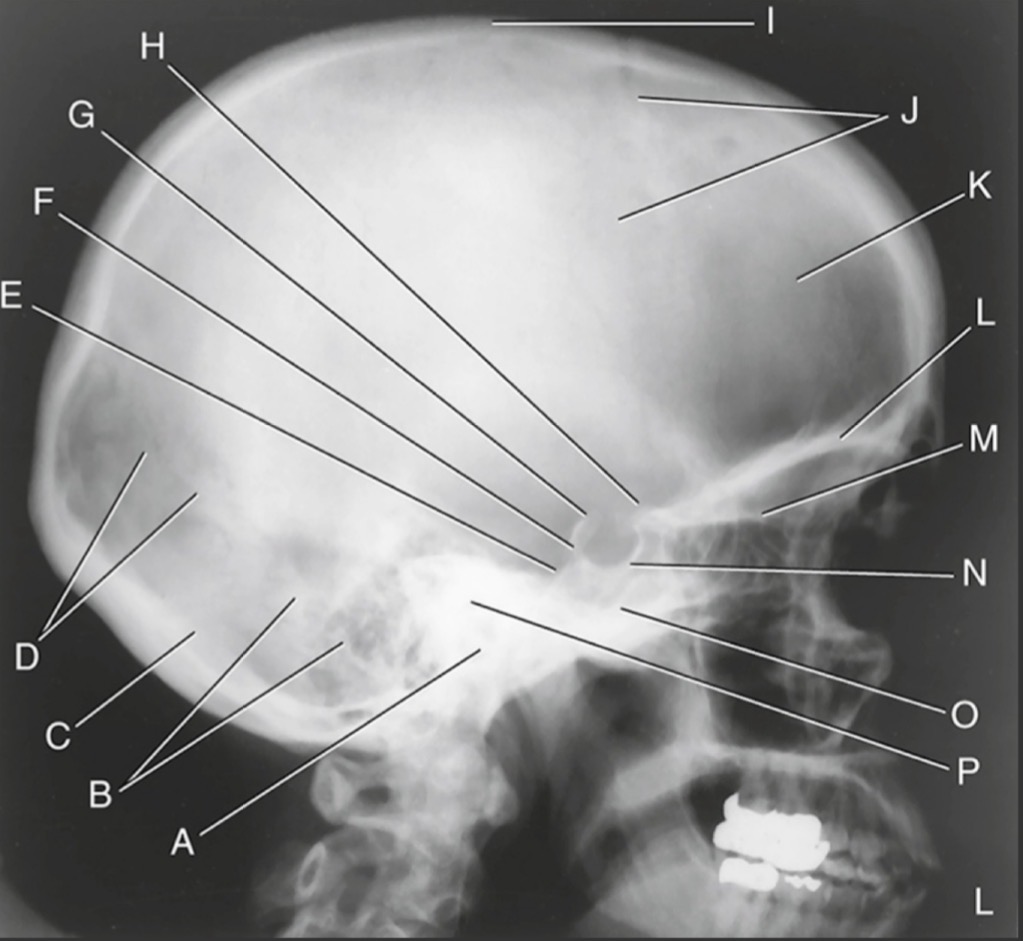 <p>K is:</p>