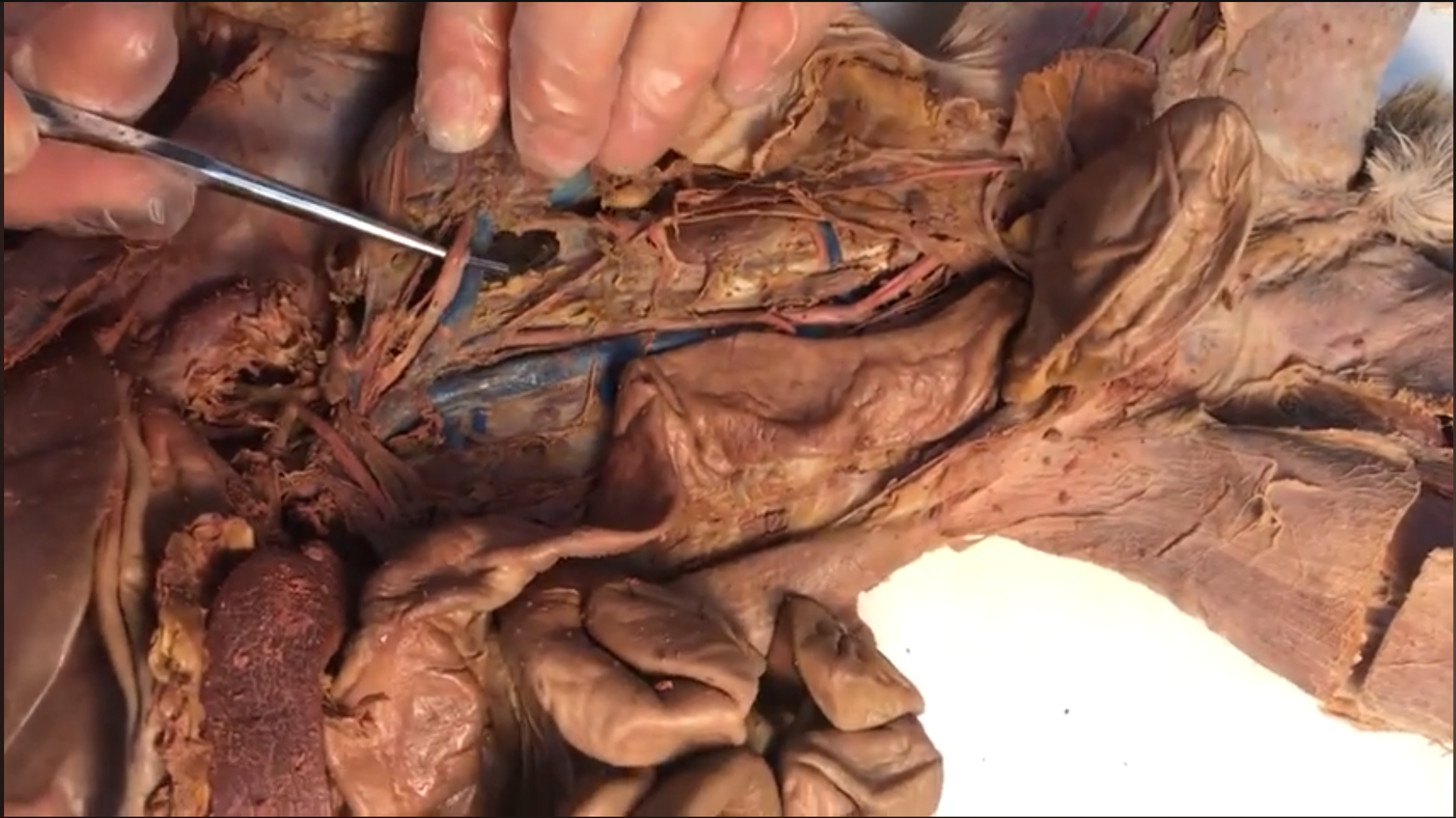 <p>What artery is this</p>