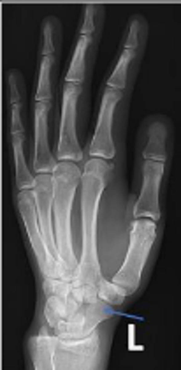 <p>What is the arrow pointing to?</p>