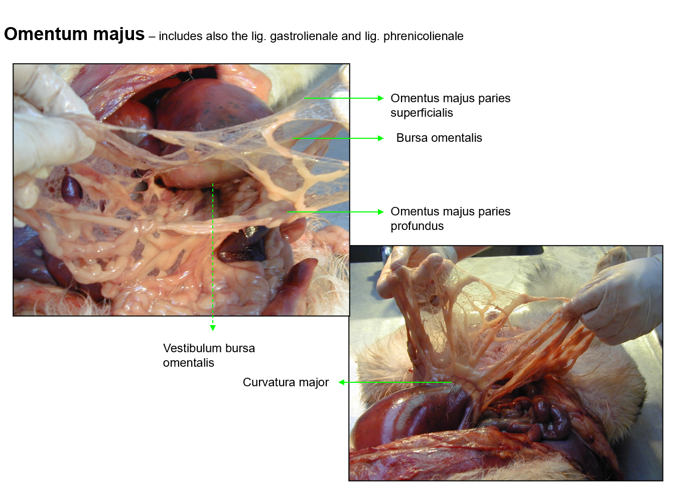 <p>Includes also the lig. gastrolienale and lig. phrenicolienale</p><ol><li><p>omentum majus paries superficialis</p></li><li><p>bursa omentalis</p></li><li><p>omentus majus paries profundus</p></li><li><p>vestibulum bursa omentalis</p></li><li><p>curvatura major</p></li></ol><p></p>