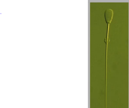 <p>What is an indicator of sperm in the cauda epididymis? </p>