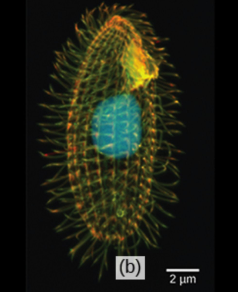 <p>ciliates</p>