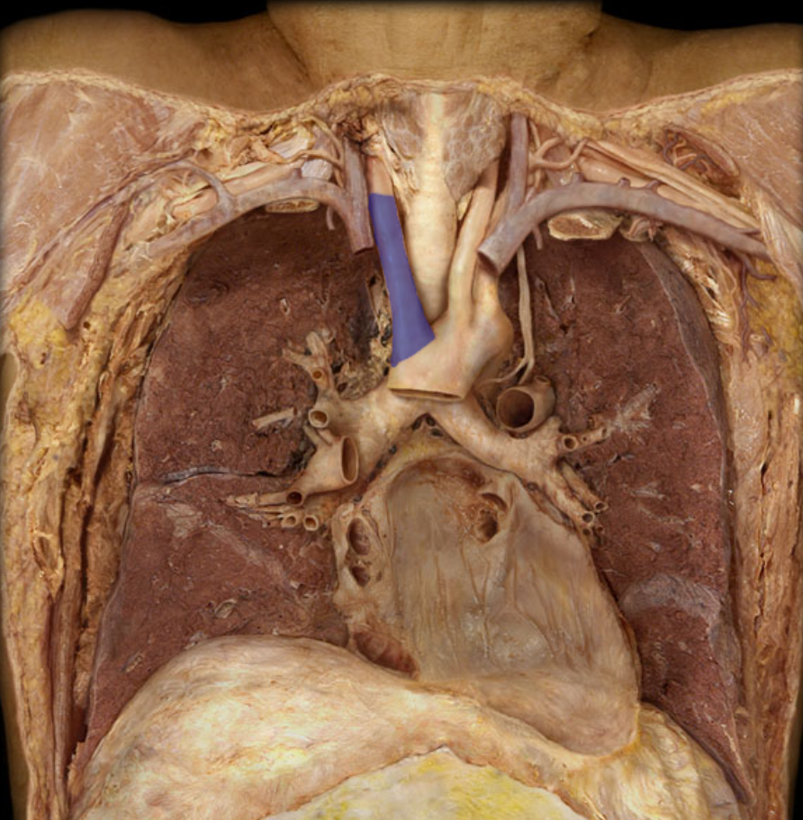 <p>Identify the structure</p>