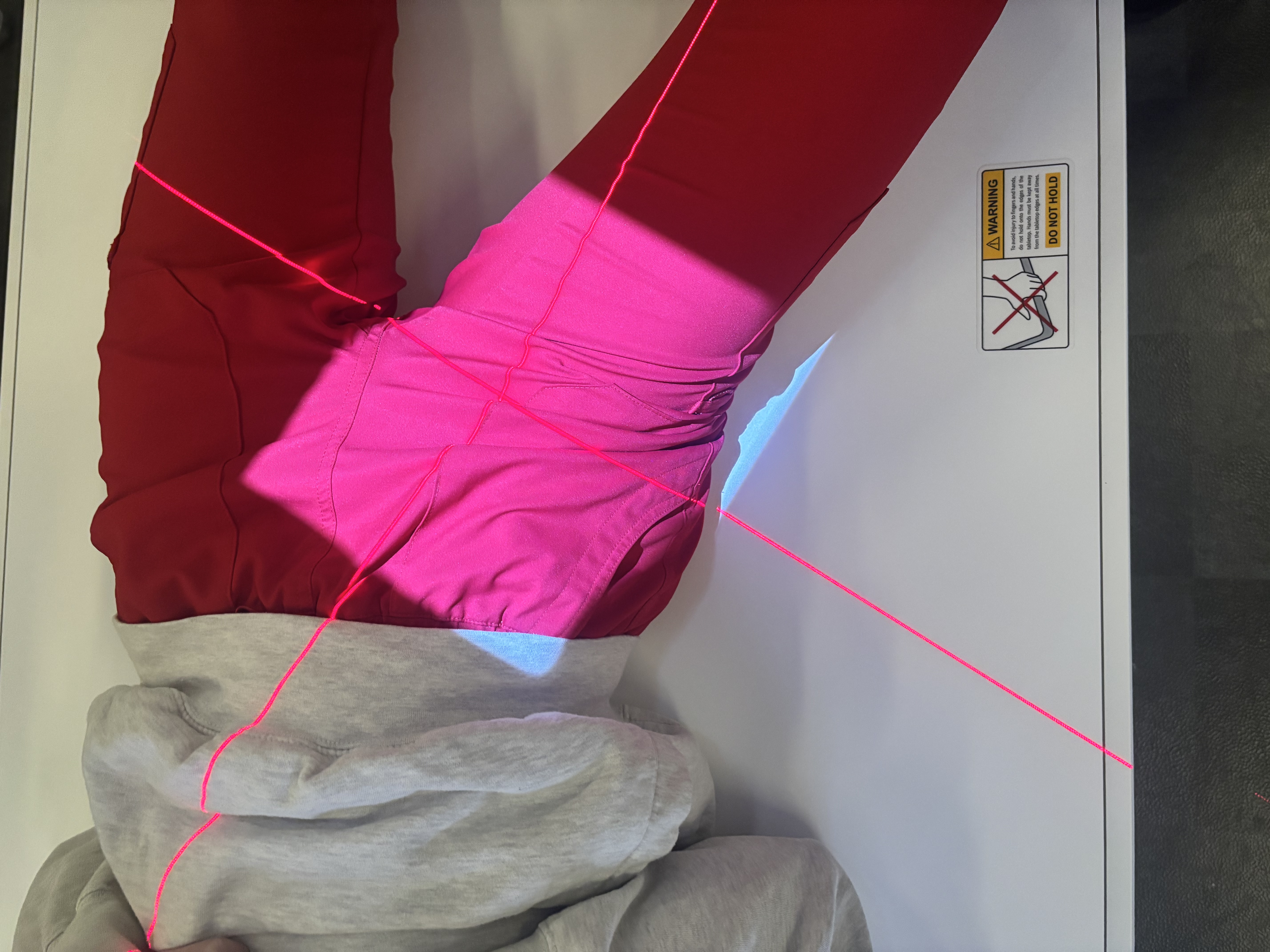 <p>Frog-Leg Hip (Modified Cleaves)</p>