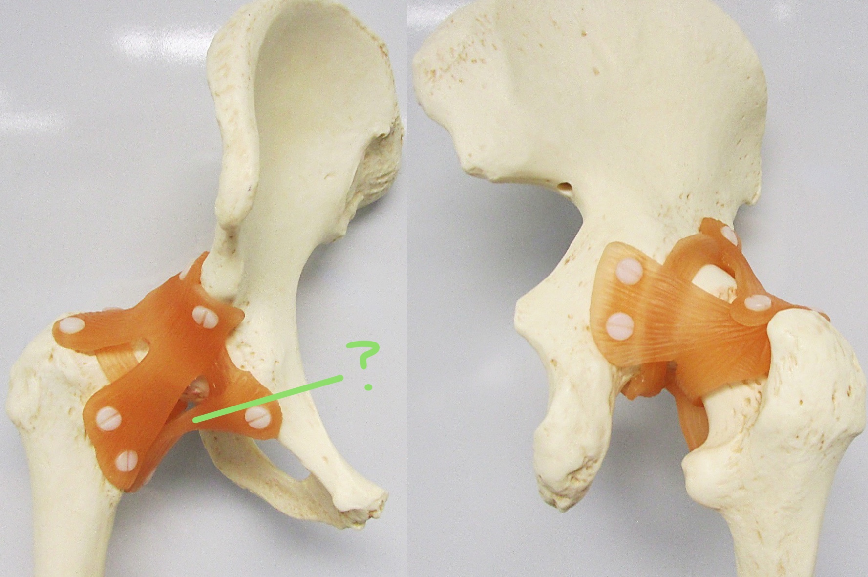 <p>Determine the part of the hip joint w/ ligament highlighted</p>