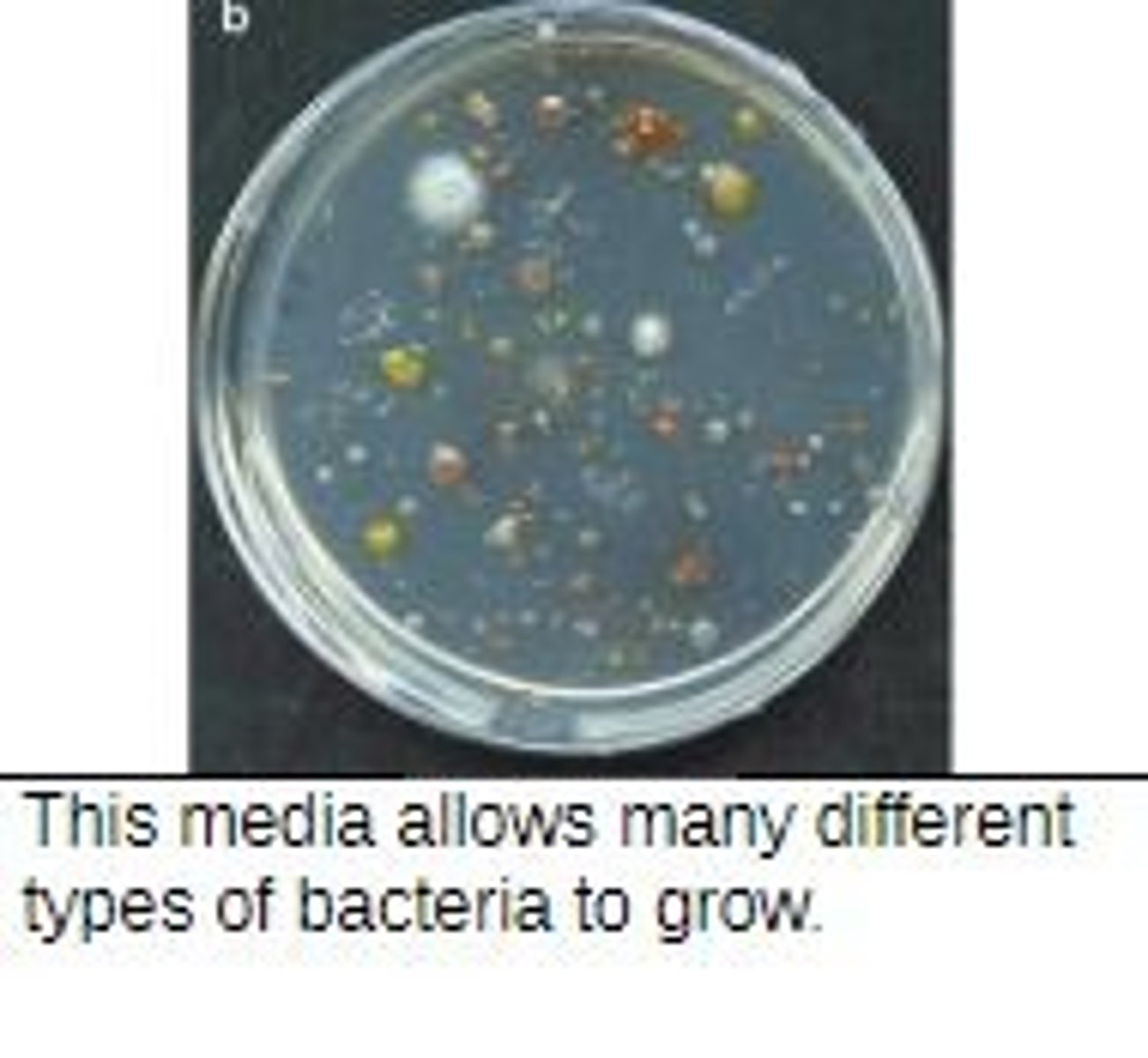 <p>supports growth of most microorganisms (nutrient agar &amp; broth, trypticase soy broth) (TSA)</p>
