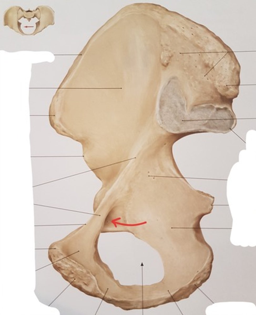<p>sulcus obturatorius</p>