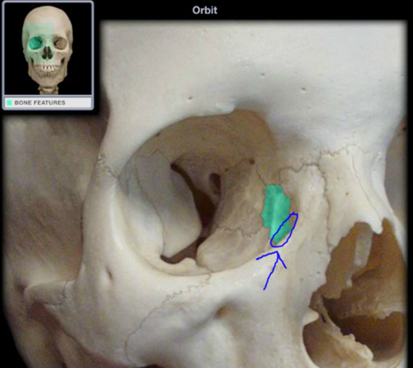 <p>nasolacrimal duct</p>