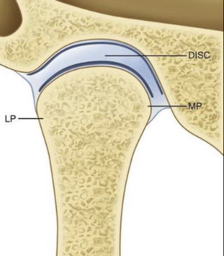 <p>lateral pole of TMJ</p>
