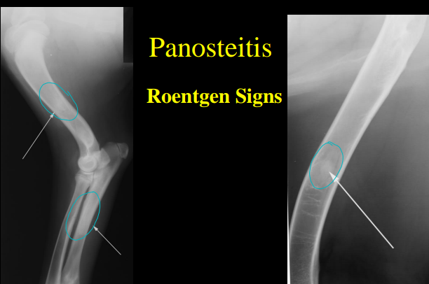 <p>Panosteitis</p>