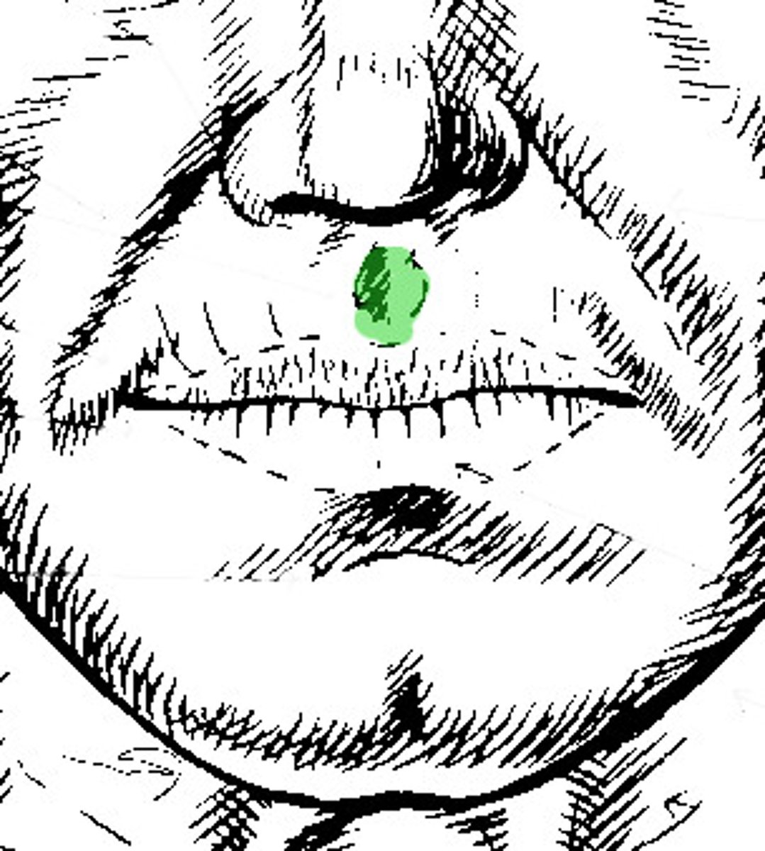 <p>groove in the upper lip that runs between columna nasi and medial lobe of upper mucous membrane</p>