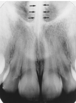 <p>identify the structure </p>