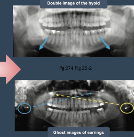 <p>what are artifacts</p>