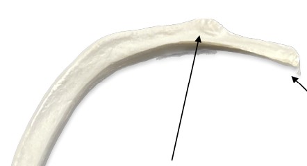 <p>What is a bump an inch down from the head of the rib?</p>