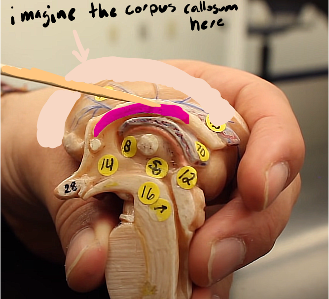 <p>brain organization pg.~434</p><p>what is this structure (it was not labeled in the book)</p>