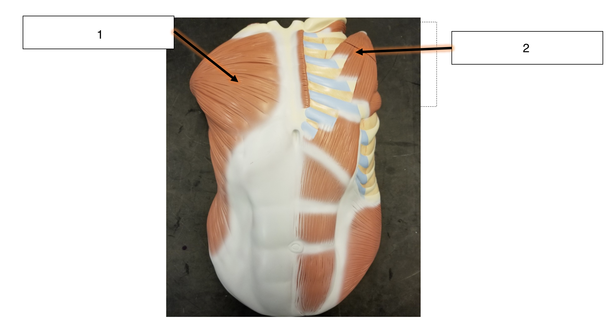 <p>name the muscle (1)</p>