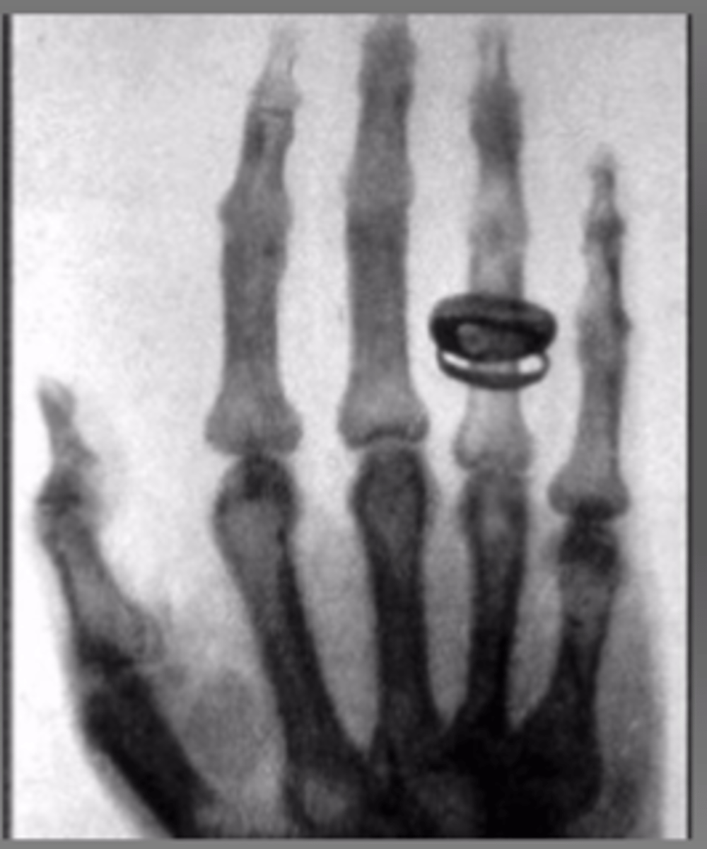 <p>of Roentgen's wife!</p>