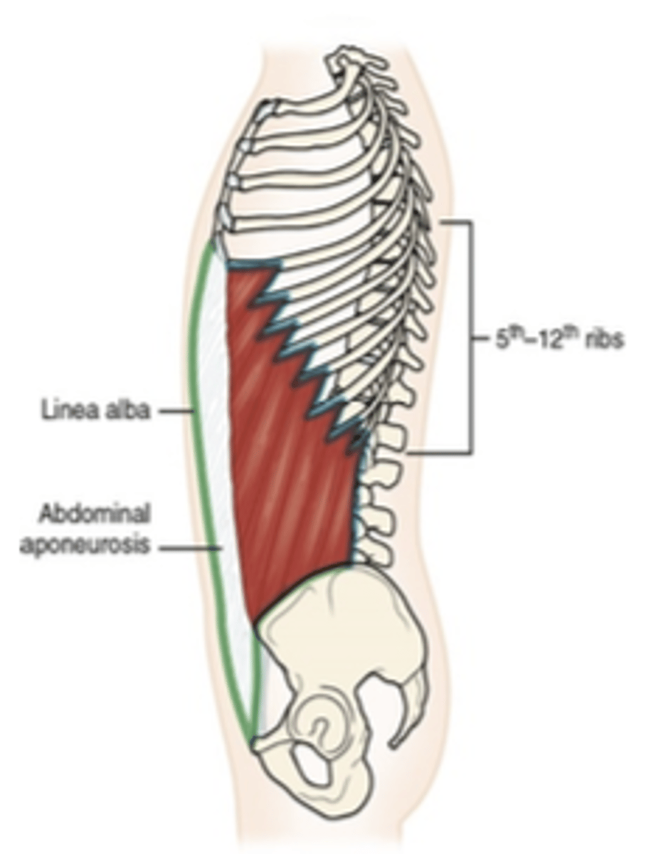 <p>What muscle is this?</p>