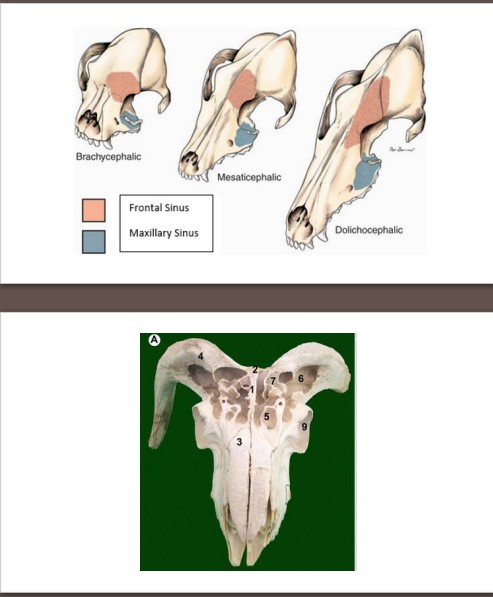 A space or cavity of air found within a bone
