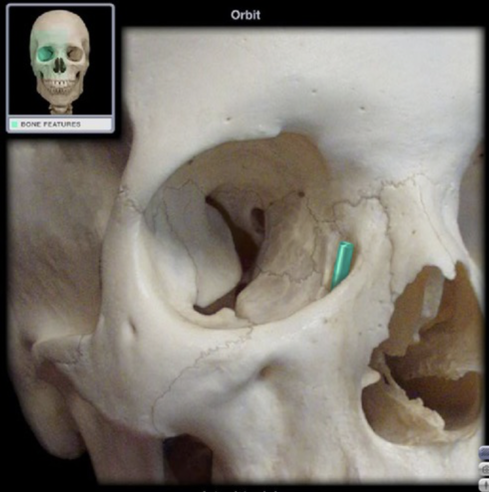 <p>depression that is home to the lacrimal gland (superior and lateral portion of the border of the orbit, part of the frontal bone)</p>