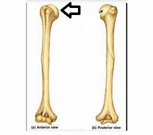 <p>what part of the humerus is this?</p>