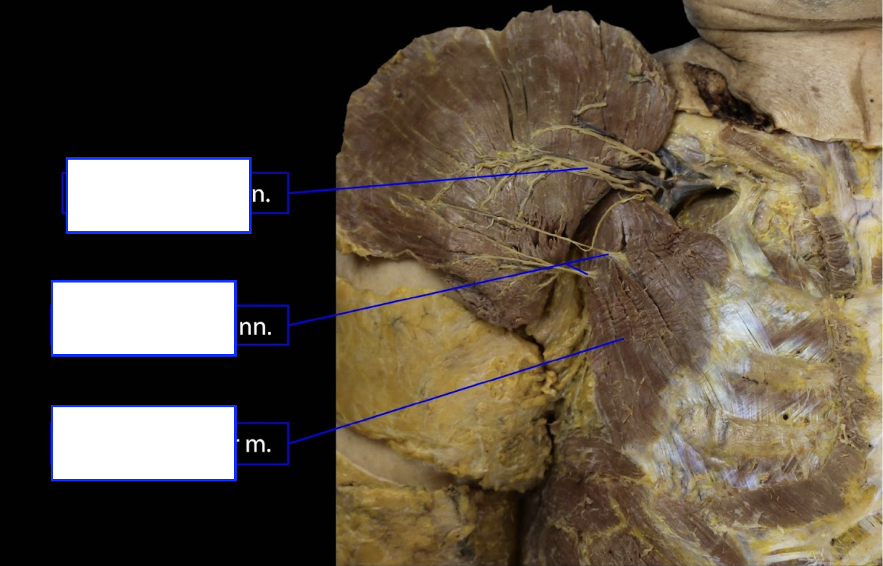 <p>bottom muscle</p>