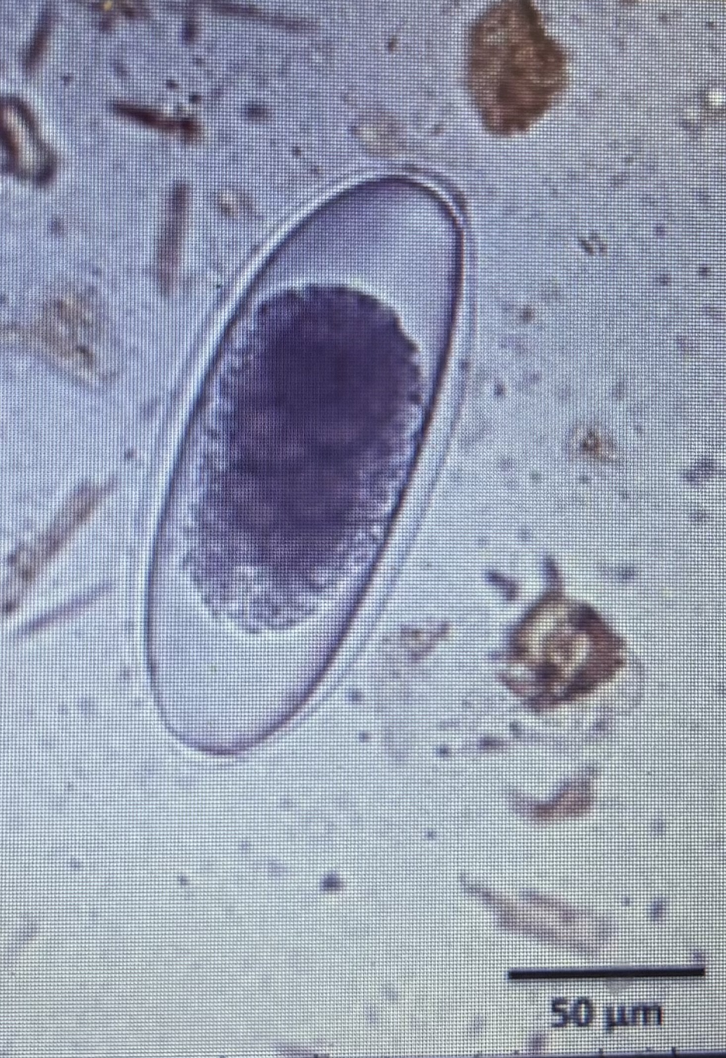 <p>Host species ruminants </p><p>Size 160-200 um x 75-100 um</p>