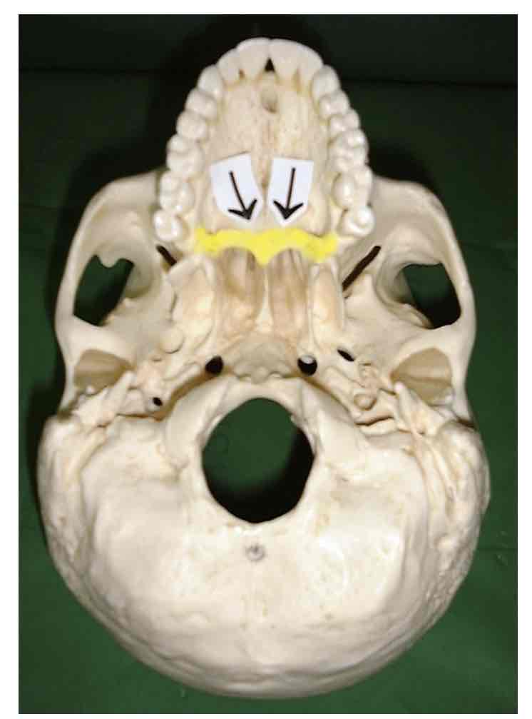 term image