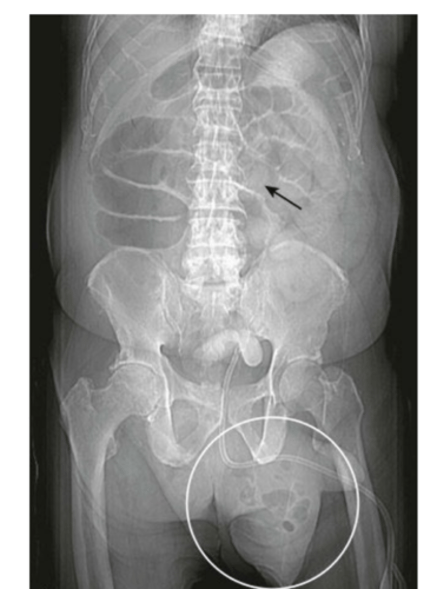 <p>identify what this is</p>