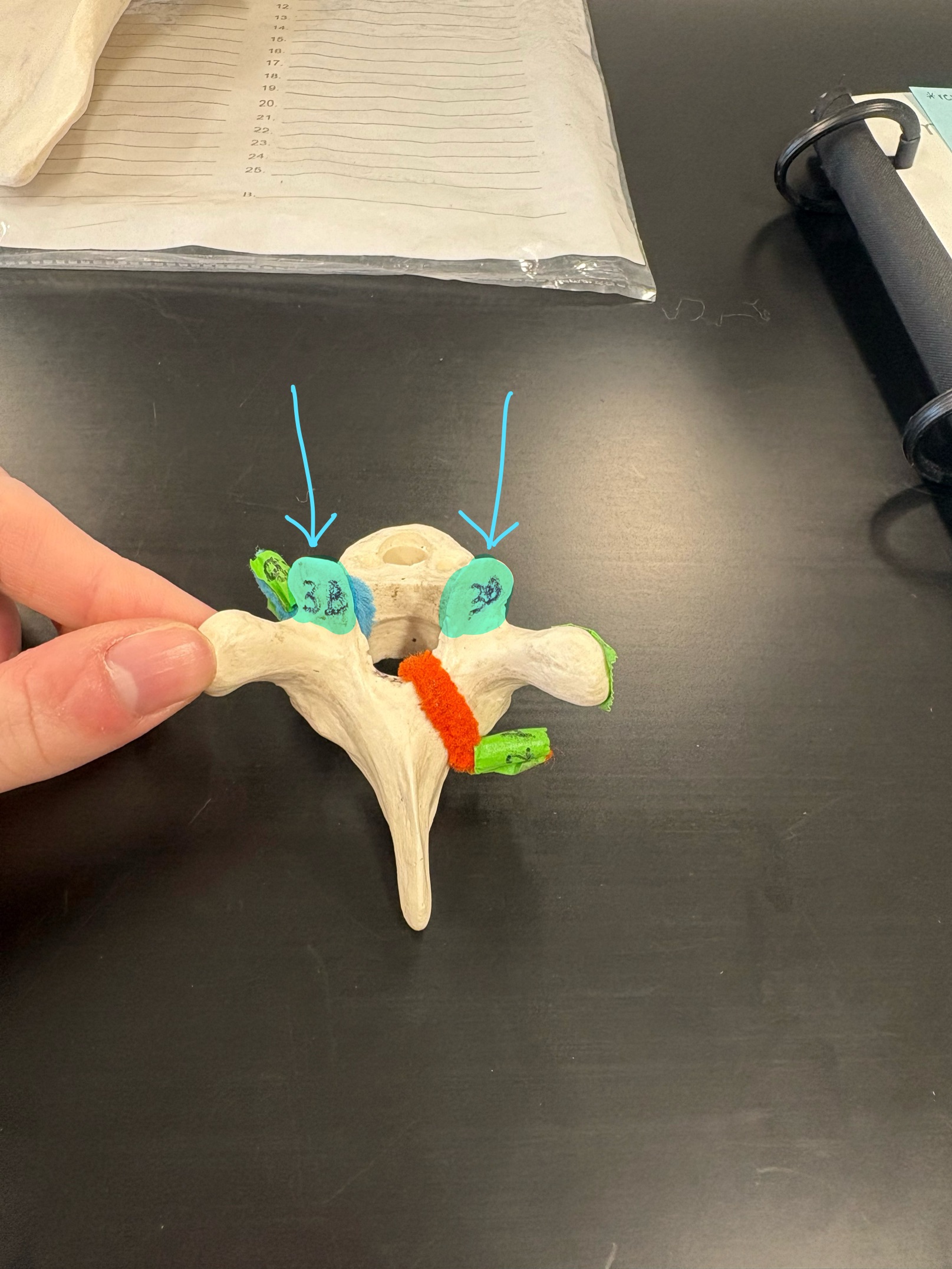 <p>Name this structure</p>