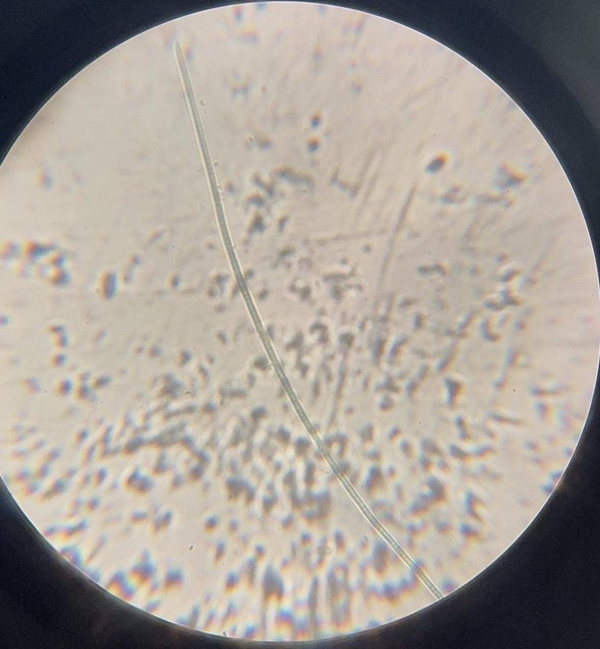 <p><span>What is this organism?</span></p>