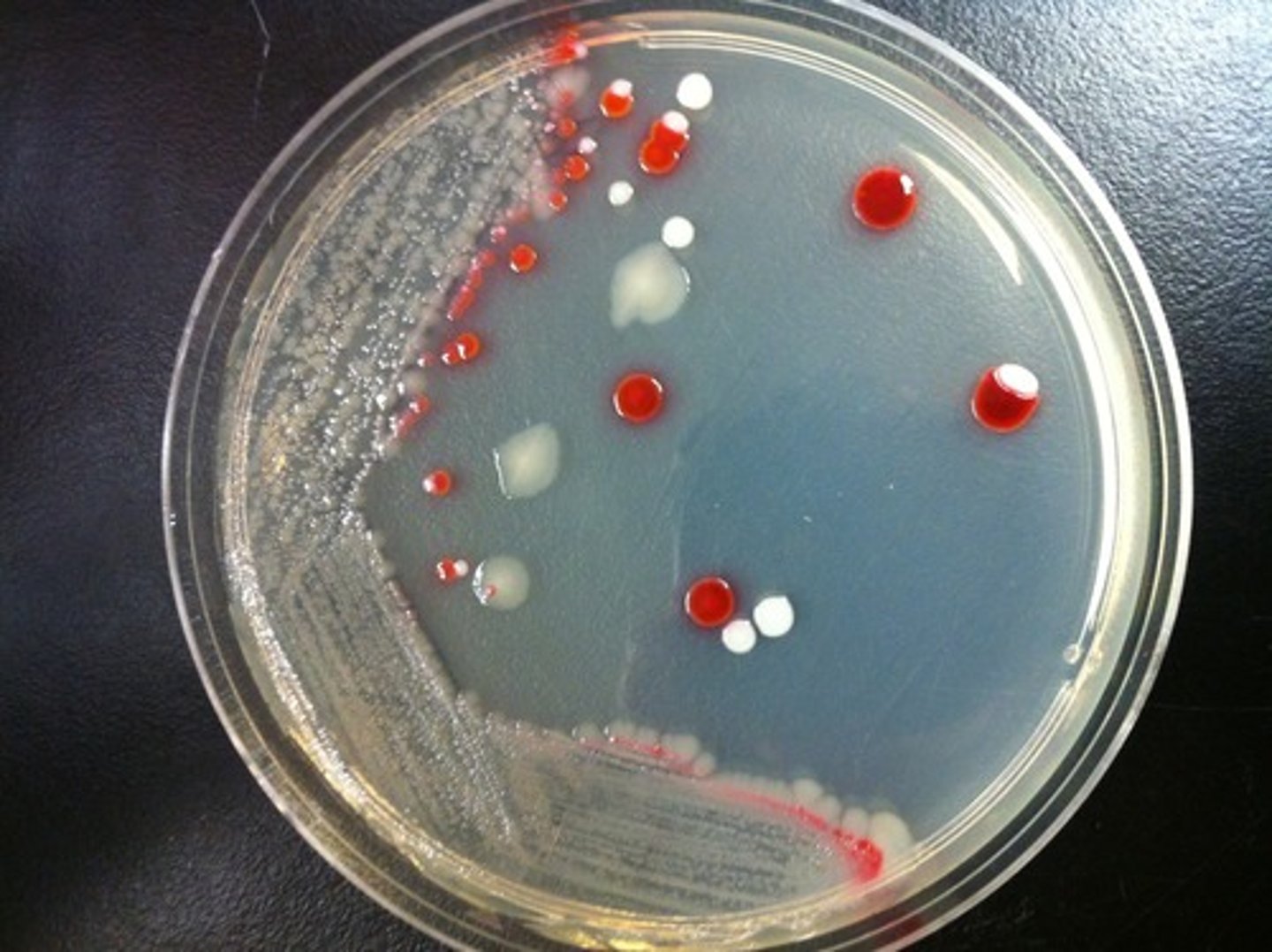 <p>The assumption is that each isolated colony in zone 3B comes from</p>