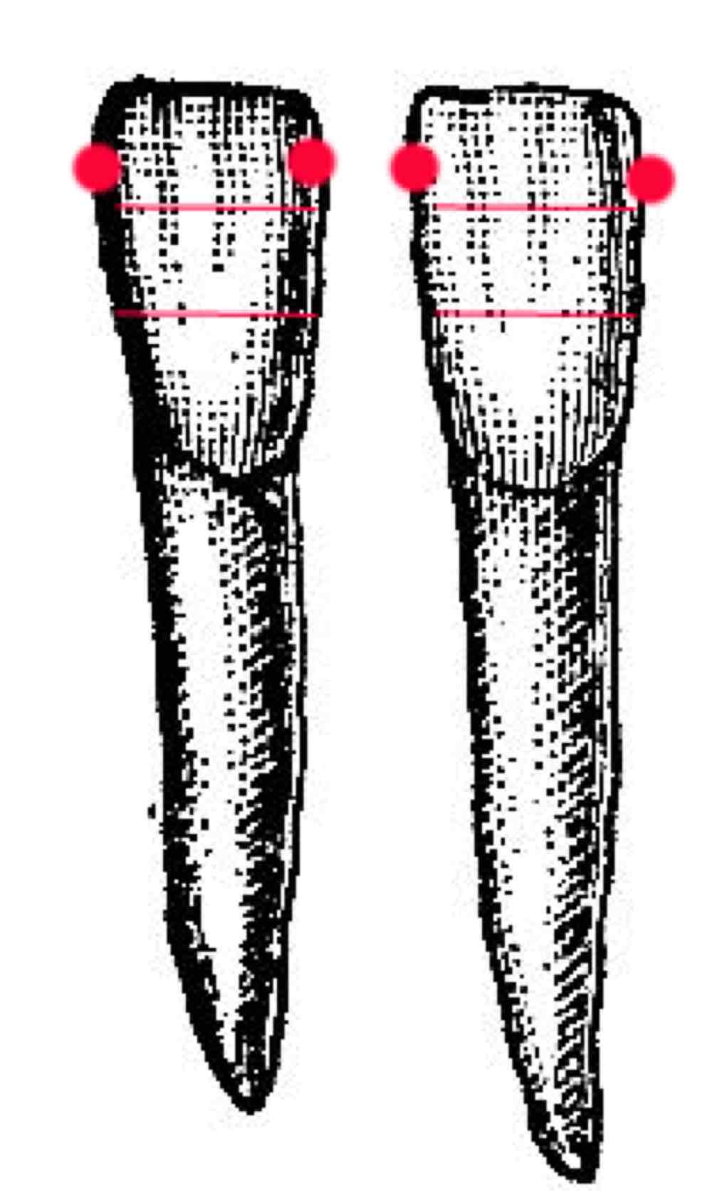 <p>what is the contact area of the distal side of the mandibular right lateral incisors?</p><p><span>*contact point between the tooth and its neighbor on the distal side is located slightly closer to the root (more apical) than the contact point on the mesial side, which is positioned closer to the crown (or more toward the incisal/occlusal edge).</span></p>