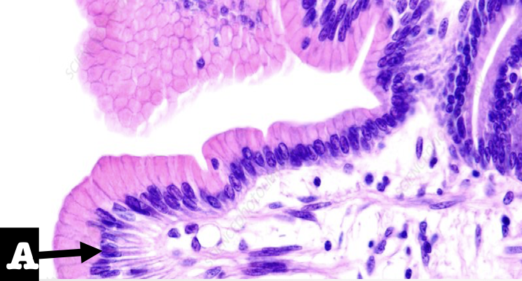 <p>What is the lining epithelium of the organ?</p>