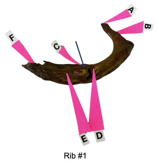 <p>Identify the neck (check tubercle after/near the neck)</p>