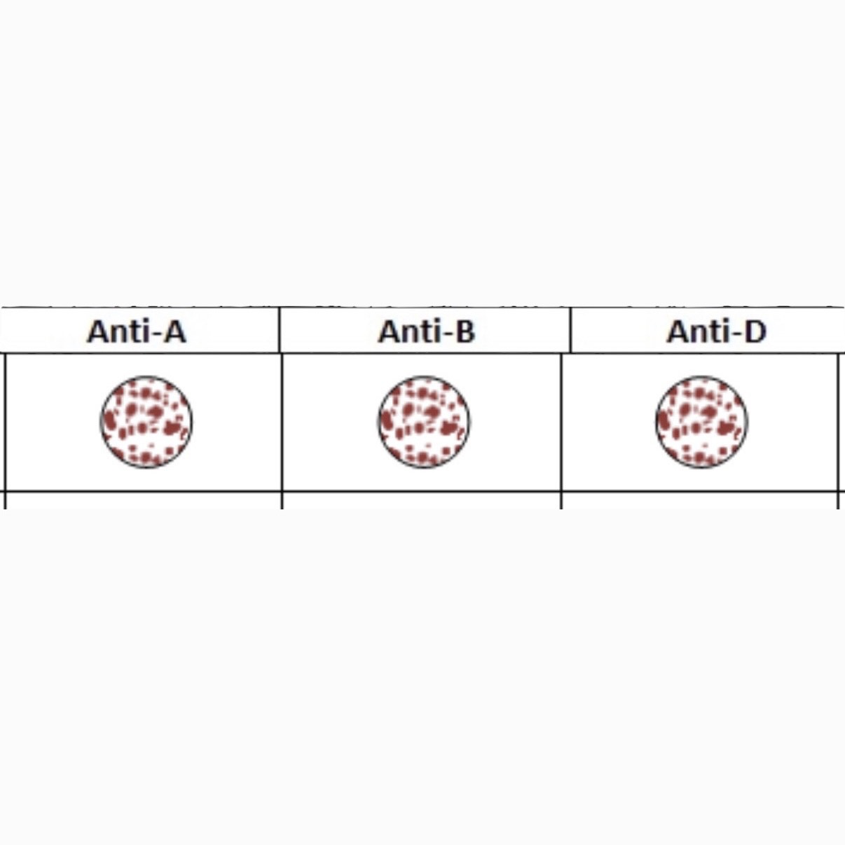 <p>What is this Blood Type? </p>