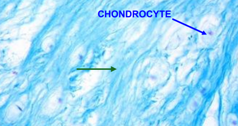 <p>What is the GREEN arrow pointing at?</p>