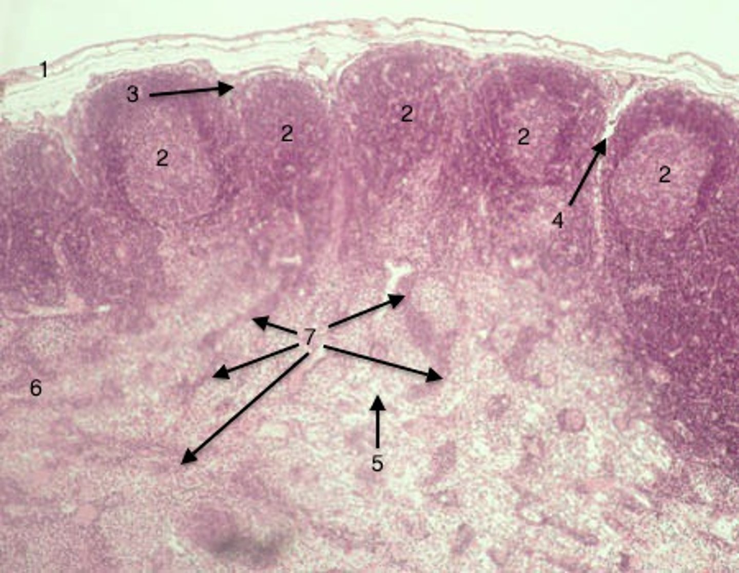 <p>dark staining "island" of cells in medulla; actually small extension of cortex made up of lymphocytes and plasma cells</p>
